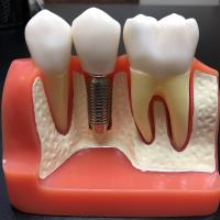 Meng Dentistry image 9